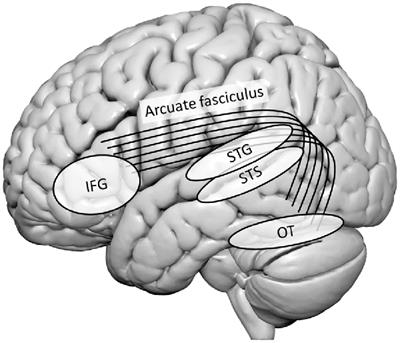 The Functional Neuroanatomy of Letter-Speech Sound Integration and Its Relation to Brain Abnormalities in Developmental Dyslexia